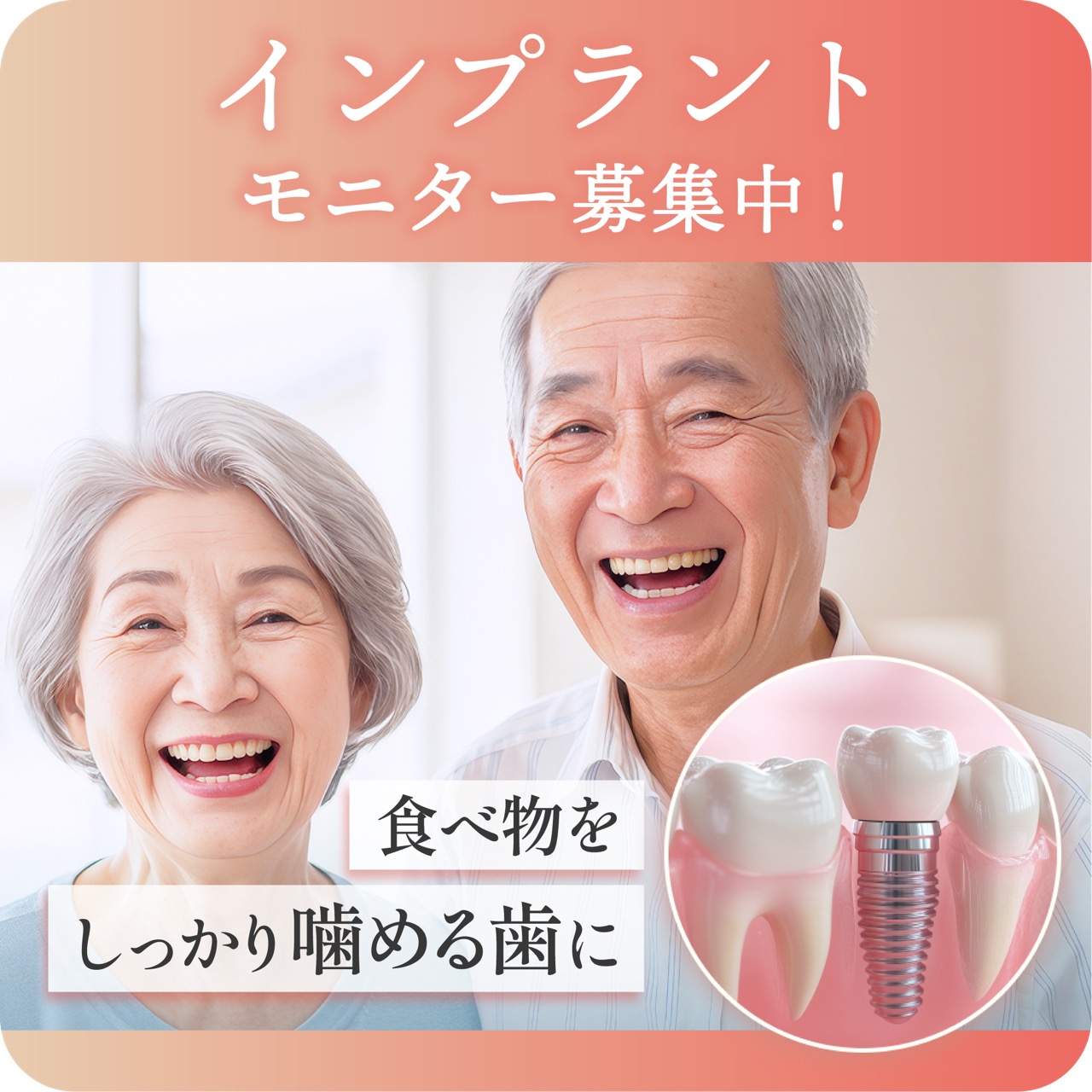 インプラントモニター募集