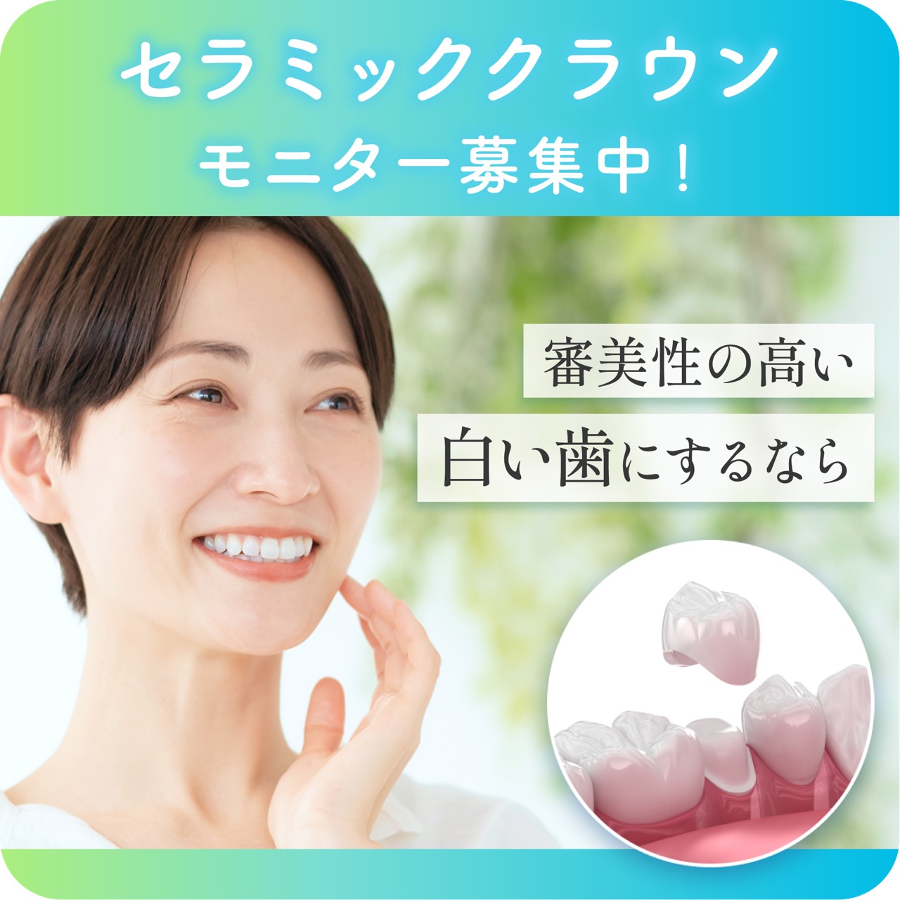 セラミッククラウンモニター募集