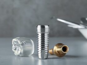 インプラント治療後にMRIはできる?できない?MRI撮影時の注意点についても解説
