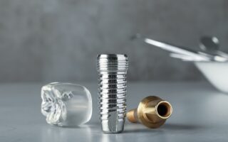 インプラント治療後にMRIはできる？できない？MRI撮影時の注意点についても解説