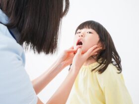 乳歯に穴があくのは虫歯が原因？虫歯じゃない原因と治療法も解説